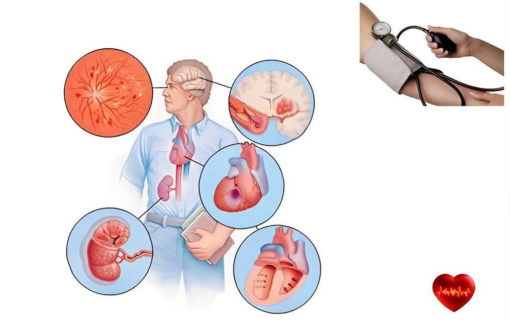 symptômes d'hypertension